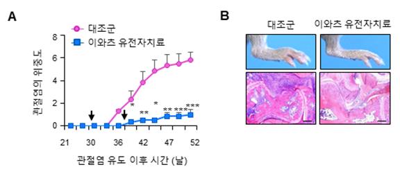 이와츠 유전자가 관절염의 진행과 악화를 현저히 억제