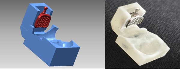 연구에 사용한 브라켓 전달 지그(왼쪽은 디지털 모델, 오른쪽은 3D 프린팅 된 형태).