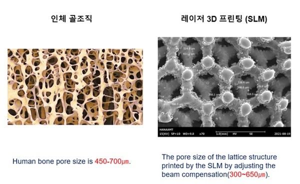 인체골조직과 흡사한 레이저3D프린팅 임플란트 사진 비교