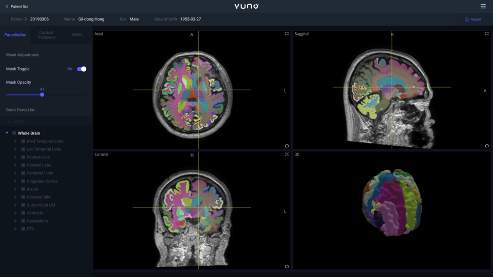 VUNO Med-DeepBrain 화면