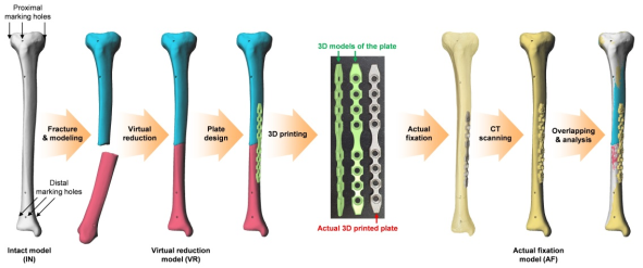  모형뼈를 CT 촬영하여 3차원으로 재구성(비교용 원본) → 모형뼈에 실제로 골절을 일으키고 CT 촬영 → 3차원 영상으로 뼈를 맞춤(가상 원형 복원) → 금속판 디자인 → 3D 프린팅으로 맞춤형 금속판 제작 → 부러진 모형뼈를 실제고정하고 CT 촬영 → 처음의 원본과 일치함을 확인