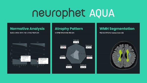 뉴로핏 아쿠아(Neurophet AQUA) 이미지