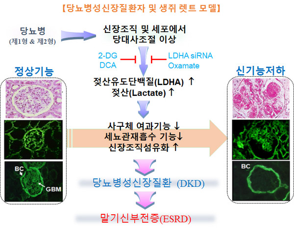 당뇨병 기인 젖산산증 유도에 의한 신장섬유화 및 신기능저하 발생 모델