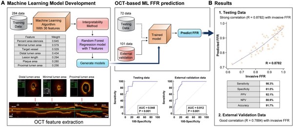 A=OCT 기반 머신러닝 도출 방법. B=머신러닝 FFR 값과 실제 측정한 FFR 값의 상관관계. 머신러닝을 통한 예측과 실제 측정값의 비교 결과 상관관계가 0.8782로 실제 측정한 값과 유사한 것으로 나타났다. 분석의 민감도와 정확도도 각각 98.3%, 91.7%로 높게 확인됐다.