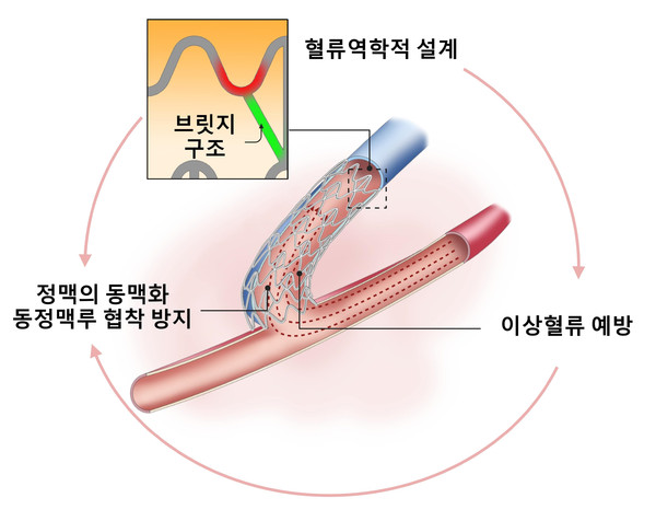 연구팀이 개발한 투석혈관 조성술 기기 개요