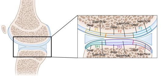 6부분(F1, F2, F3, TP1, TP2, TP3의 표면층, 심층)으로 나눈 관절 이미지