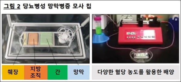 당뇨병성 망막병증 모사 칩