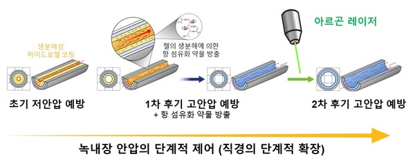 연구팀 개발 방수 튜브의 녹내장 병기에 따른 안압 조절 원리.