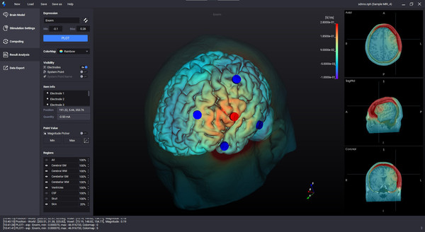 NEUROPHET tES LAB : 국내 1호 뇌영상치료계획소프트웨어