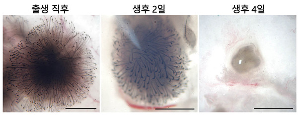 [자료2] 생후 0~4일째 섬유아세포 비교