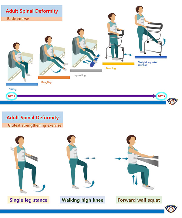 기본 재활 프로토콜(위), 둔부근육강화운동(아래)