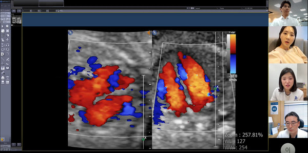 보호자와 산모, 2차 의료기관(미즈메디병원 전진동 진료부장), 세브란스병원(권하얀 산부인과 교수) 주치의가 산모의 초음파 검사 결과를 함께 보며 협진을 하는 모습.