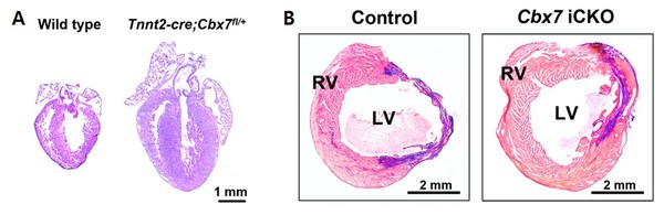 A=마우스모델의 심장(왼쪽)에서 Cbx7 유전자 활성을 조절해 심근세포를 억제했을 때 심장의 크기가 증가하고 심근의 두께가 증가했다(오른쪽). B=심장마비 마우스모델(왼쪽)에서 Cbx7 유전자를 제거한 결과, 심장 섬유화가 감소하고 심근이 증가했다(오른쪽).